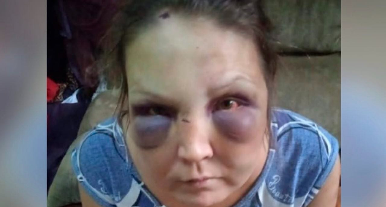 Брат угрожал расправой: бишкекчанку нашли со следами побоев