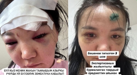 В Оше девушка заявила о жестоком домашнем насилии