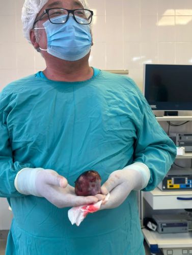 Doctors in Bishkek operate on eight-day-old baby with tumor